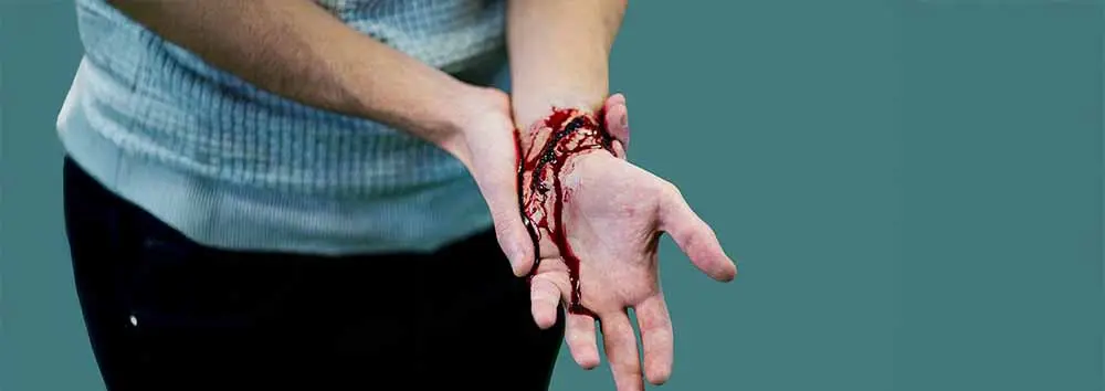 Hémorragie externe : gestes de premiers secours pour stopper le saignement