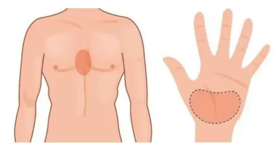 Position des mains à avoir pendant un massage cardiaque